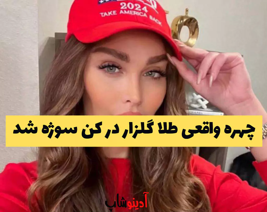 چهره واقعی طلا گلزار در کن سوژه شد | کاربران: باورمون نمی‌شه!