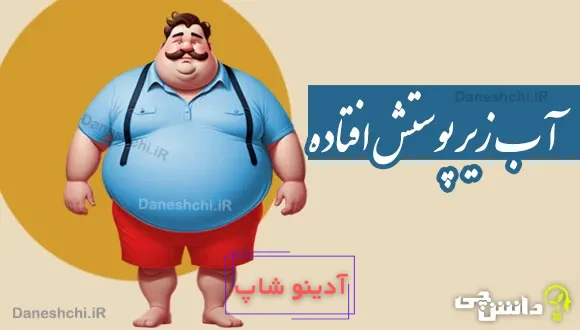 آب زیر پوستش افتاده 