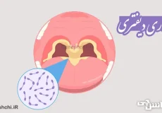 تحقیق در مورد بیماری دیفتری | علائم و راه های انتقال آن
