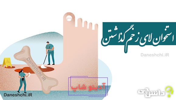 استخوان لای زخم گذاشتن