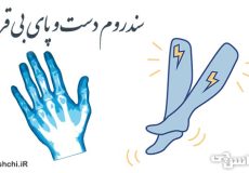 سندروم دست بی قرار