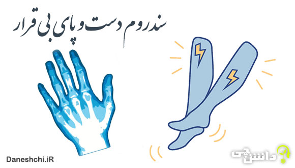 سندروم دست بی قرار