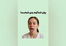 تشخیص بیماری از روی رنگ زبان