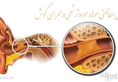 نقش حفاظتی موها و مواد ترشحی در مجرای گوش