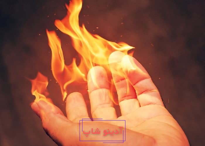 تعبیر خواب سوختن