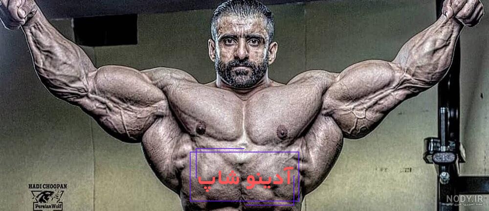 رونی کلمن در آغوش هادی چوپان + تصویر