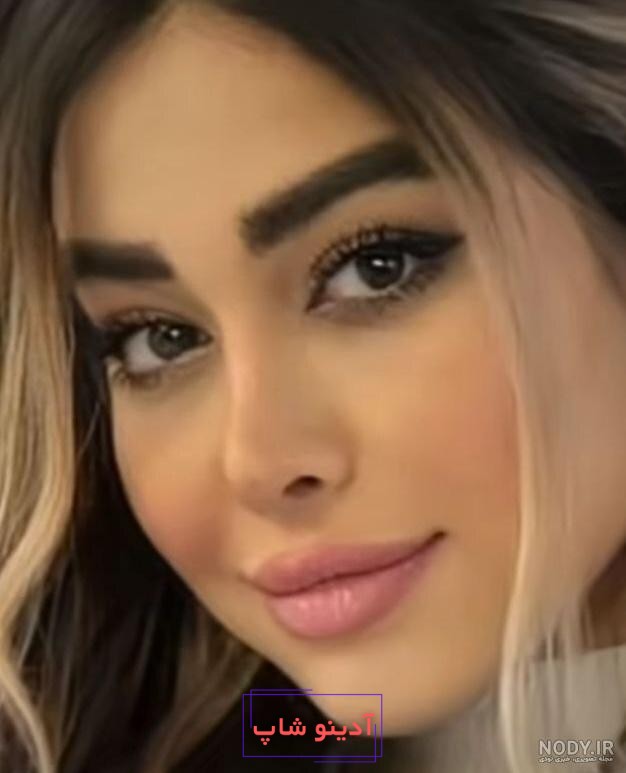 عکس| اولین پست اینستاگرامی حامیم بعد از تصادف - قدس آنلاین