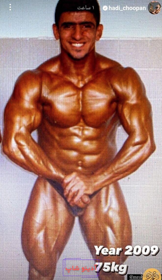 هادی چوپان 2023 : هادی چوپان رونی کلمن رو با خاک یکسان کرد