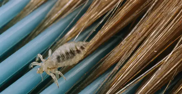 تعبیر خواب کشتن شپش سر + معنی کشتن شپش سر در خواب های ما چیست