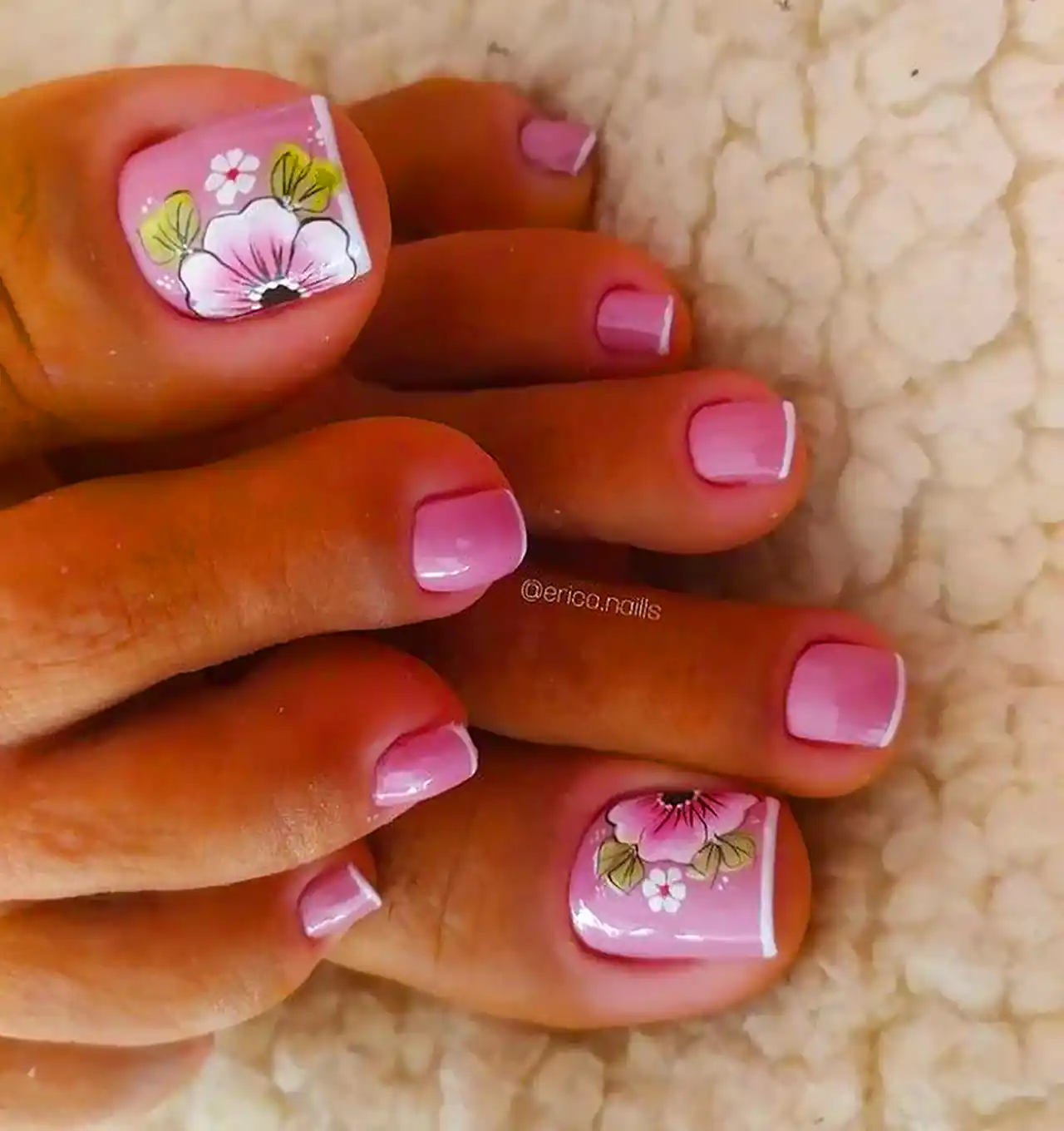 لاکژل برای پا