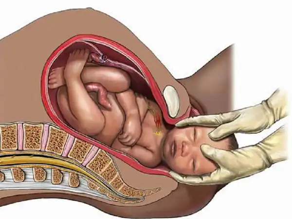 تعبیر خواب زایمان طبیعی ابن سیرین + برای زن متاهل و باردار و دختر مجرد و از دید مولف